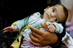 WHO Chief Warns of ‘Catastrophic Hunger’ in Gaza